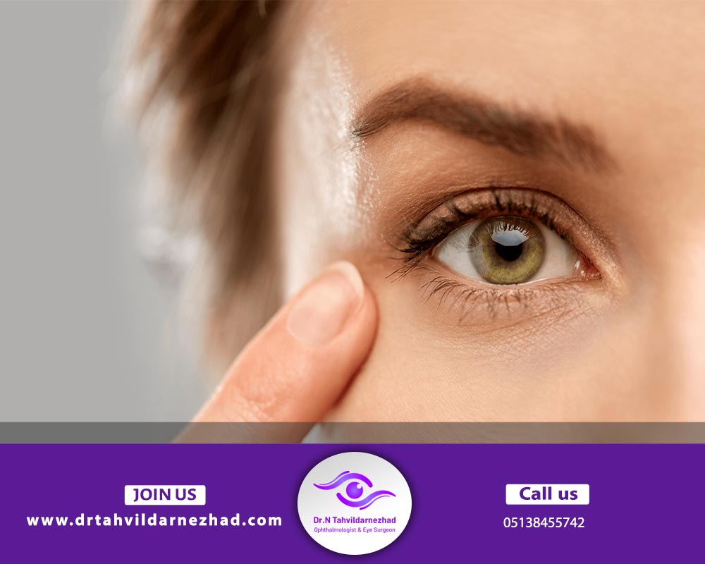 جراحی  چشم گربه ای چیست