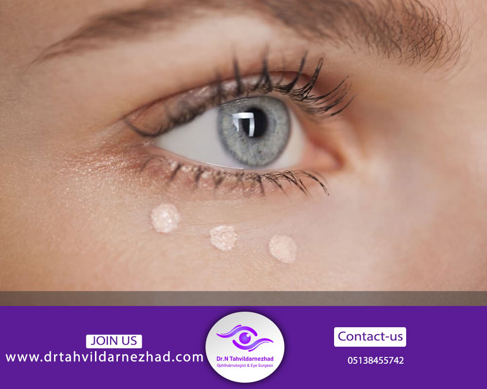 ریشه بیماری پوستی میلیا چیست؟