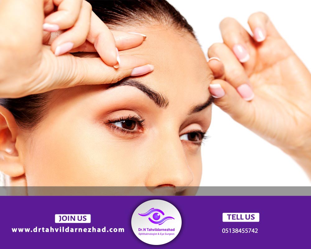 لیفت کامل آندوسکوپی پیشانی، ابرو، شقیقه