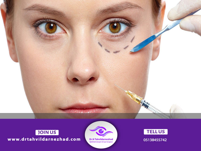 تزریق فیلر برای از بین بردن گودی شقیقه