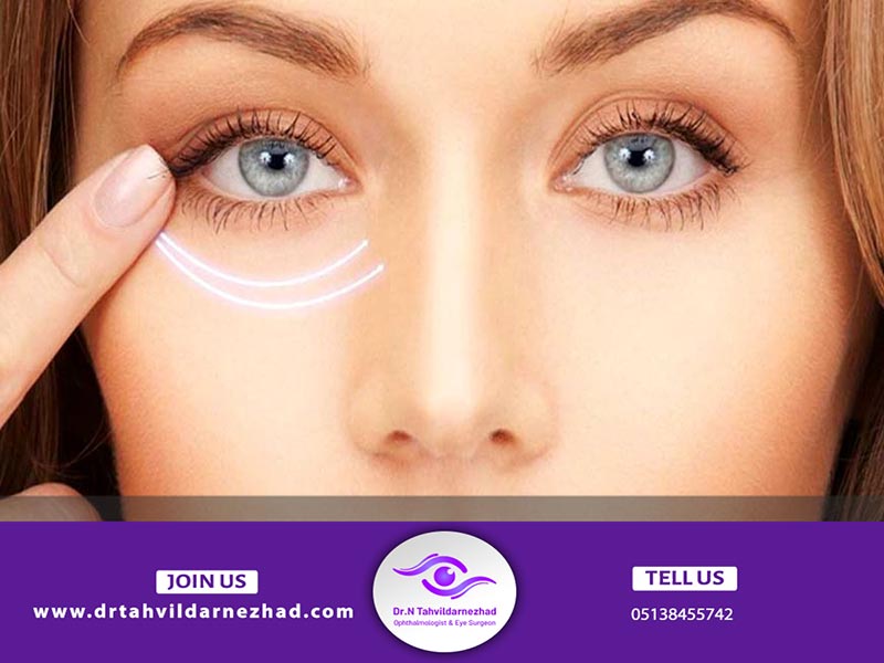 میوپاتی چشمی چیست و چگونه درمان می شود؟