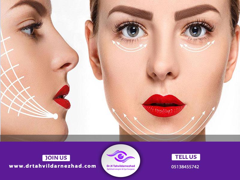 کاربرد لیفت نخ