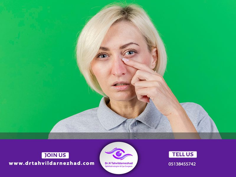 کوچک شدن چشم بعداز جراحی بلفارو به دلیل داشتن سابقه جراحی