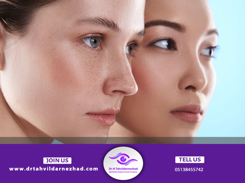 تفاوت تزریق ژل و چربی در زیر چشم