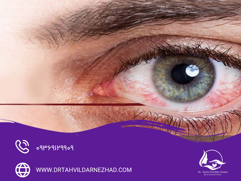 شبکیه و نقش آن در بینایی