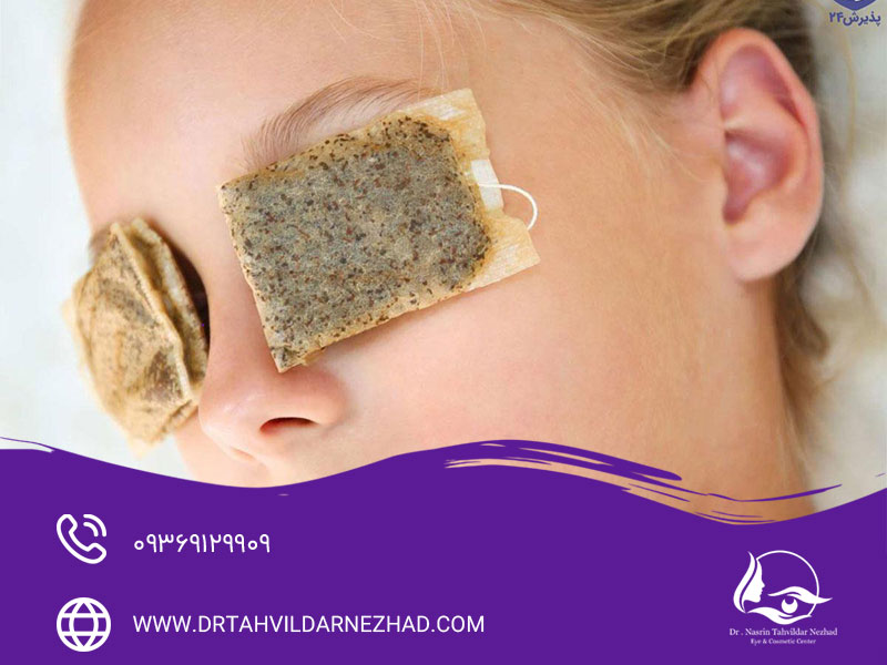 روش های درمان افتادگی پلک با طب سنتی