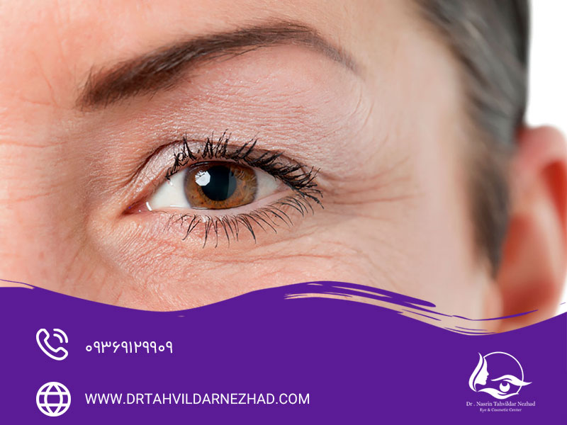 استفاده از محصولات مراقبتی مناسب برای پوست دور چشم