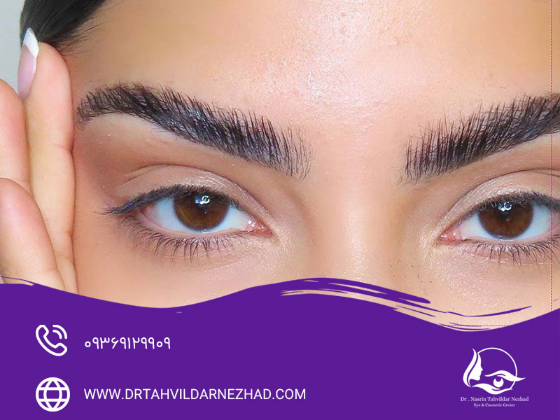 انواع روش‌های لیفت ابرو
