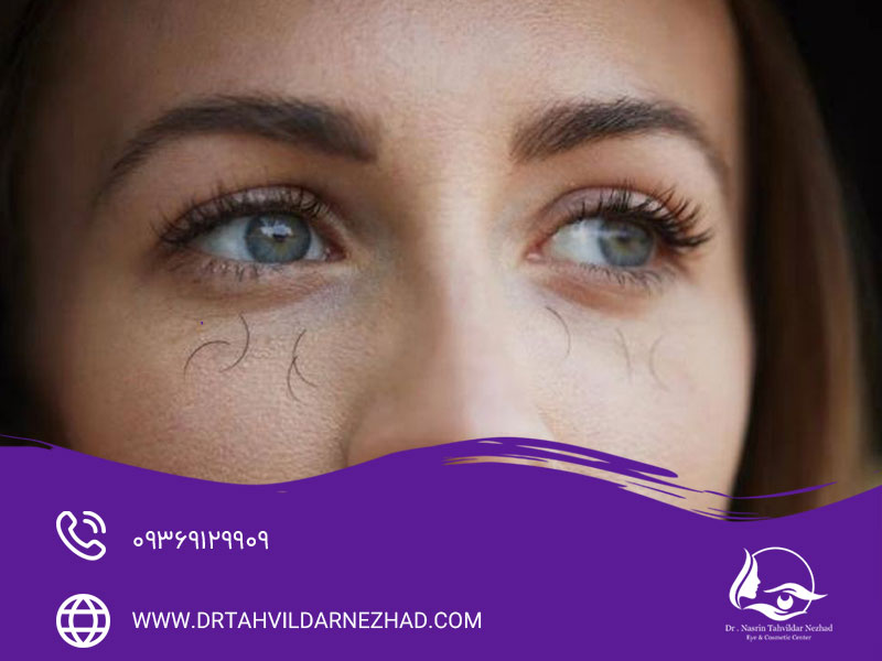 ۱. استفاده بیش از حد از لوازم آرایشی