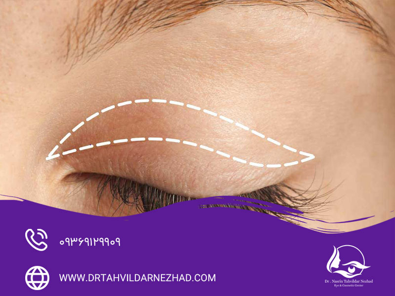 درمانهای خانگی و طبیعی (با احتیاط)