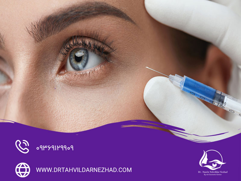تزریق چربی زیر چشم