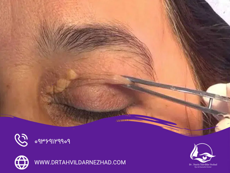 نوع پوست و عوامل ژنتیکی