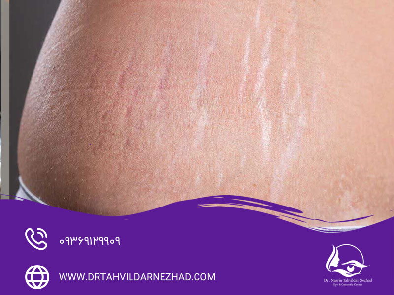 نکات مهم در پیشگیری و مراقبت