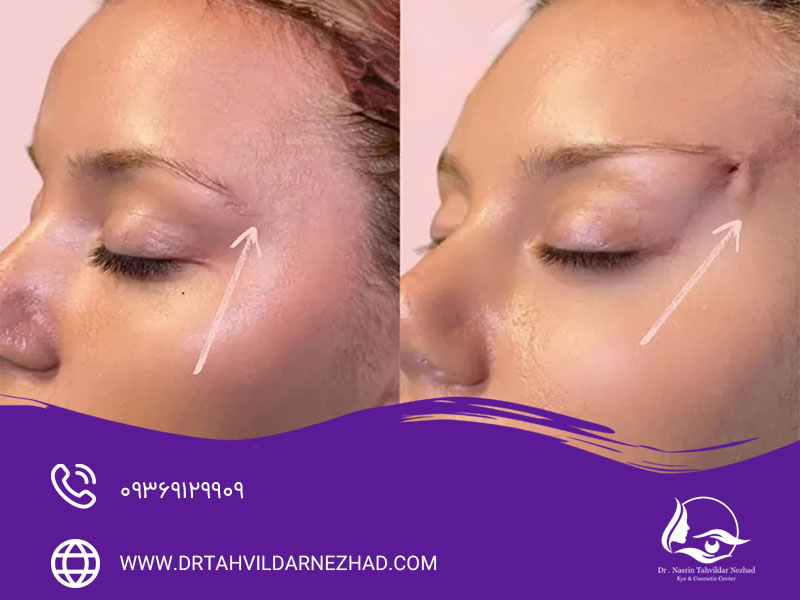 نتایج طبیعی و تدریجی