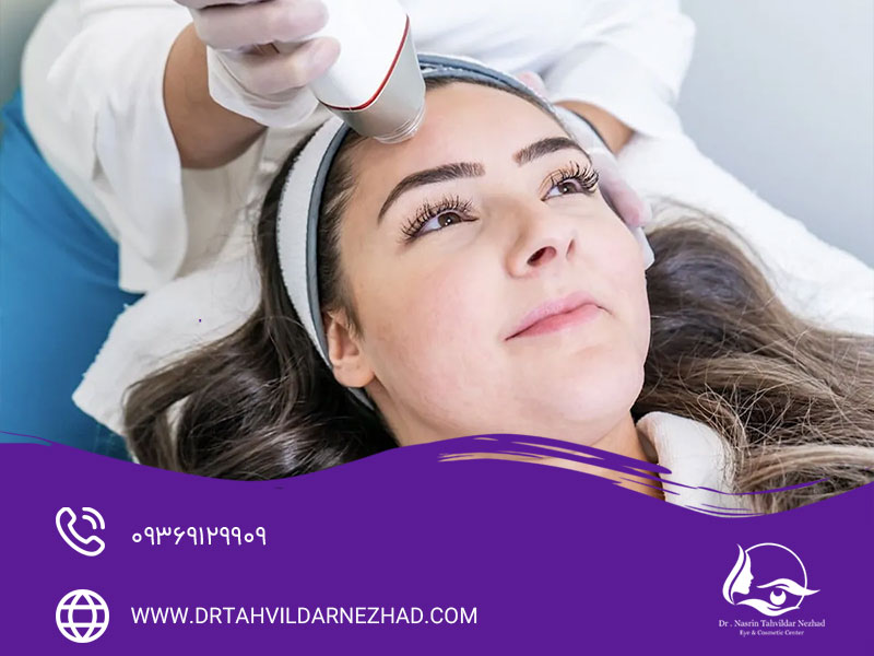 نحوه رفع خط خنده با آر اف فرکشنال