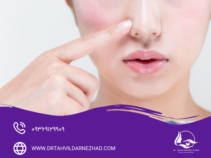 پماد ترمیم‌کننده موپیروسین برای بخیه