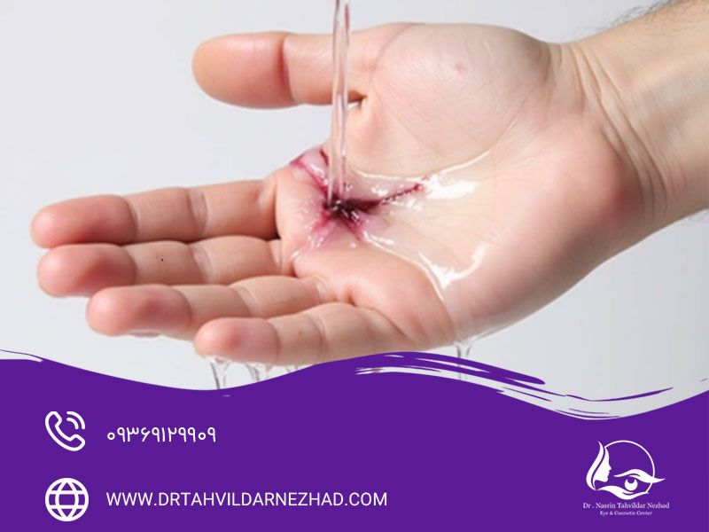 آیا آب برای زخم ضرر دارد؟
