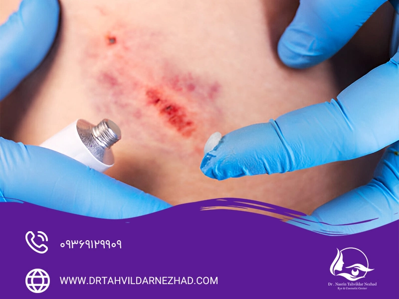 پماد ترمیم‌کننده تتراسایکلین
