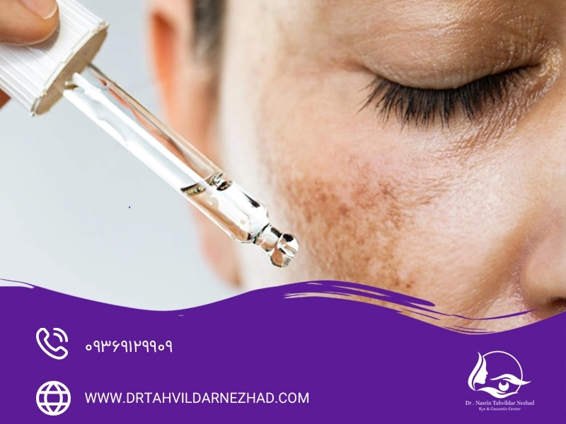 کاهش لک‌های پوستی و مدیریت پیگمنتیشن