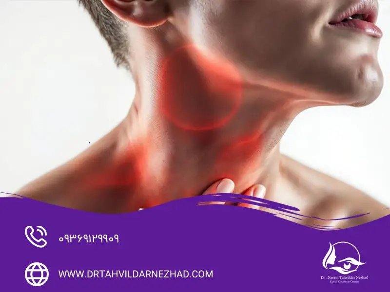 کپسول سفالکسین ۵۰۰ برای گلودرد