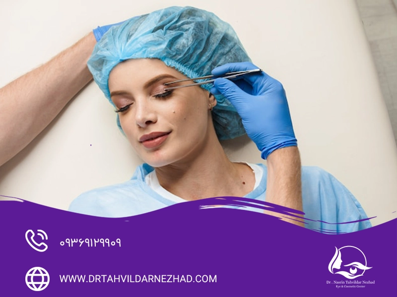 جراحی پلک یا هایفوتراپی پلک