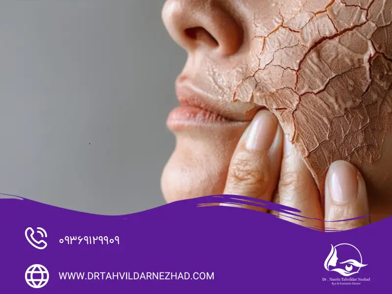 عوارض جانبی کلیندامایسین