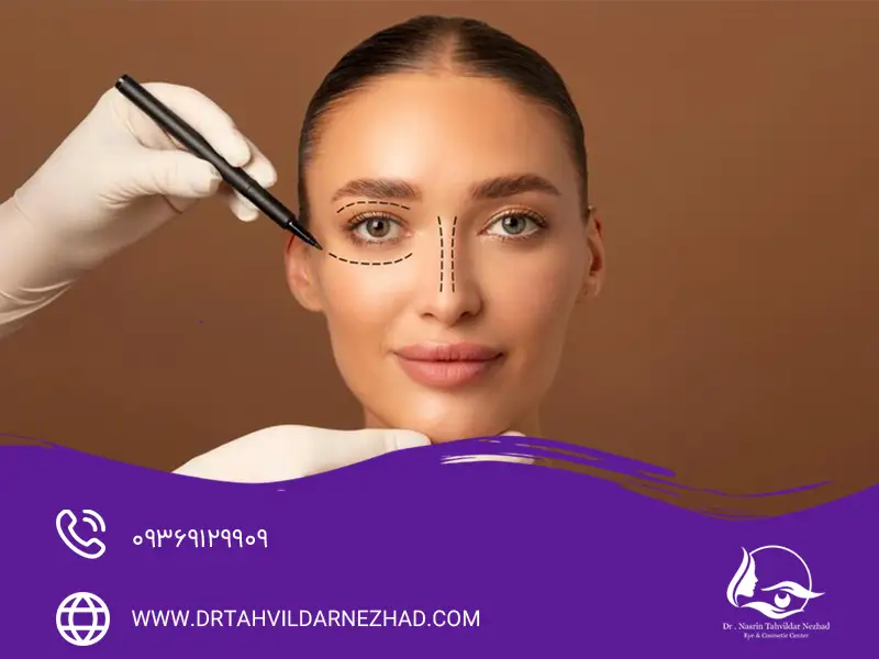 تاثیر سبک زندگی (خواب، تغذیه، استرس) بر نتیجه بلفاروپلاستی
