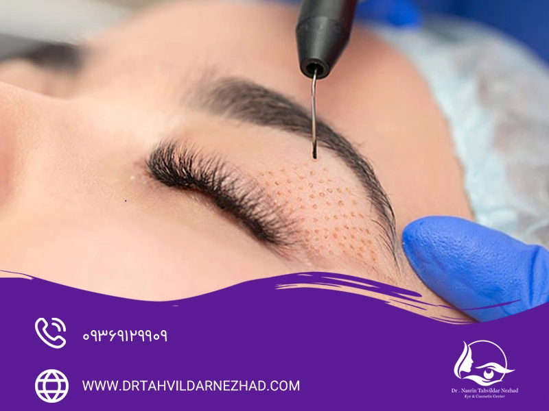  مزایای پلاسماجت
