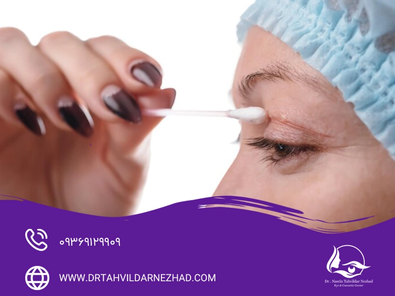 چطور از خشکی یا التهاب چشم بعد از جراحی بلفاروپلاستی جلوگیری کنیم؟