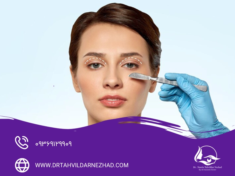  تفاوت اصلی بلفاروپلاستی و تزریق فیلر زیر چشم