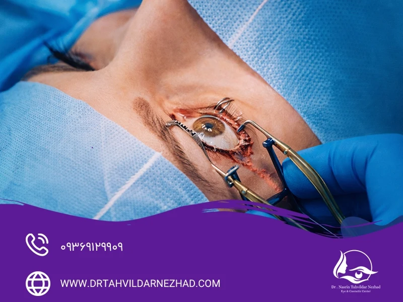  معایب و عوارض احتمالی پی‌آر‌کی