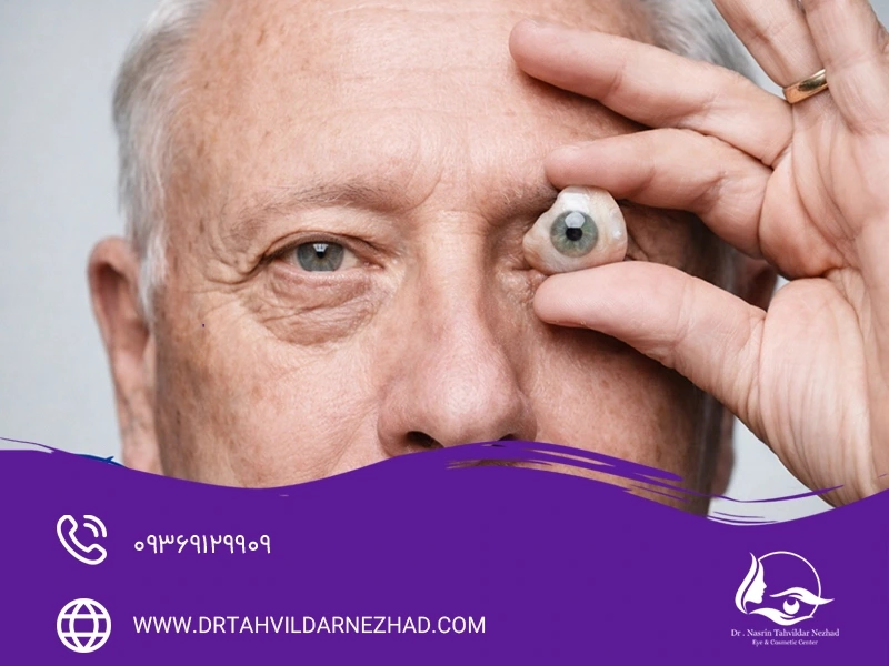  تخلیه چشم چیست و چرا انجام می‌شود؟