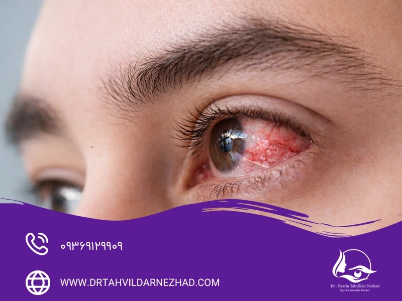  علائم هشداردهنده پس از تخلیه چشم