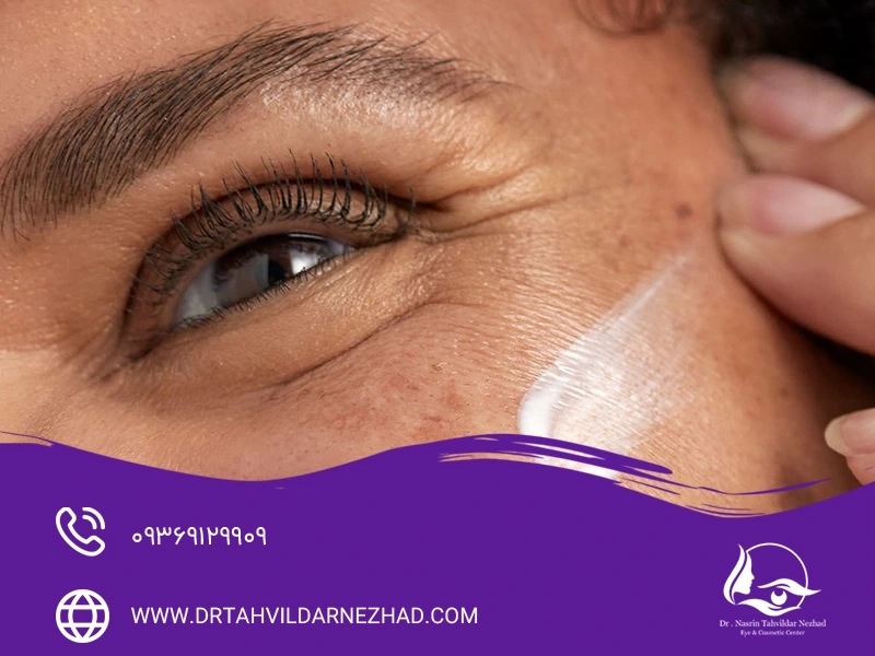 موثرترین روش ها برای از بین بردن خطوط پنجه کلاغی کنار چشم