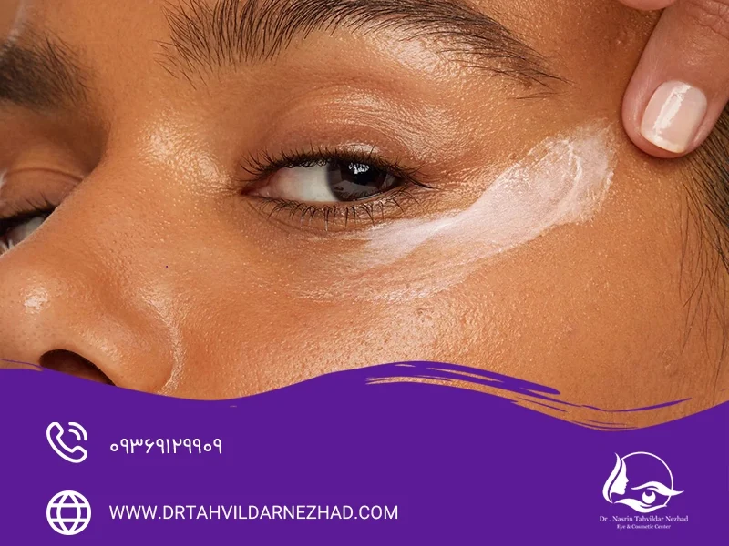 خطوط پنجه کلاغی کنار چشم را چگونه از بین ببریم؟