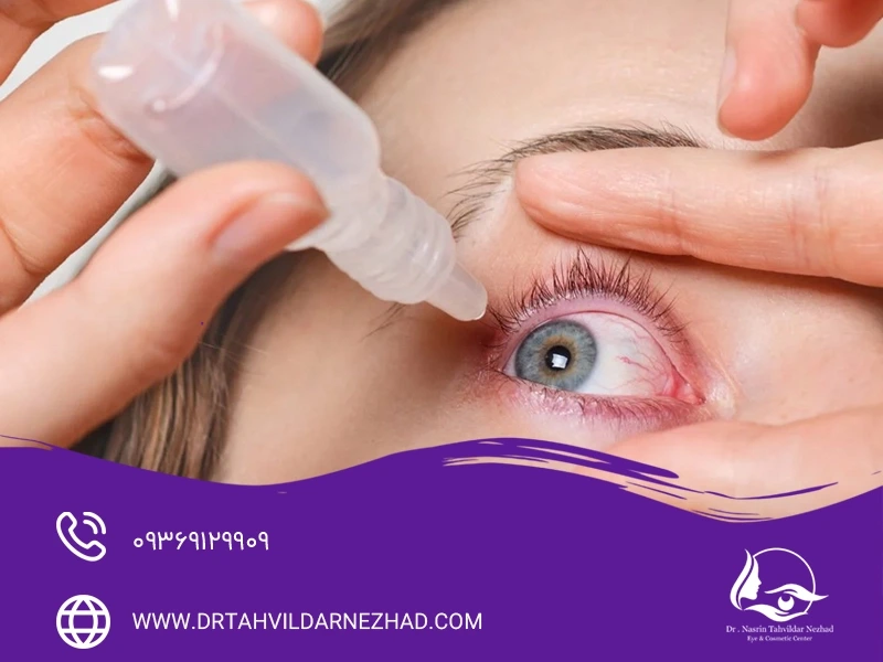  بهترین قطره‌ها برای رفع قرمزی چشم