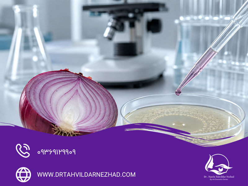 استفاده از پیاز برای ضدعفونی بخیه
