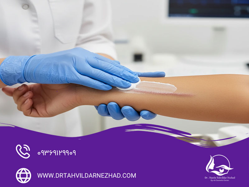 کرم اسکار رژودرم