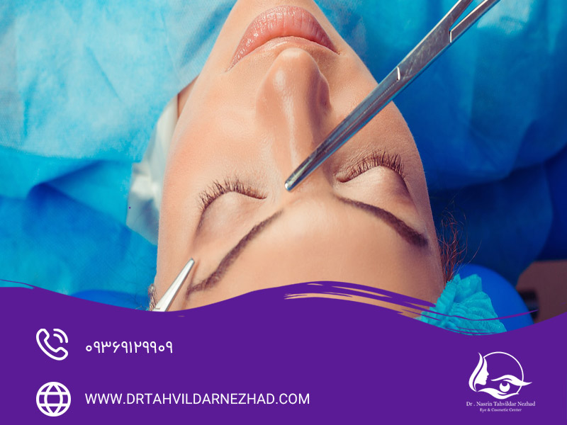 روش جراحی چگونه بر ماندگاری لیفت ابرو تأثیر می‌گذارد