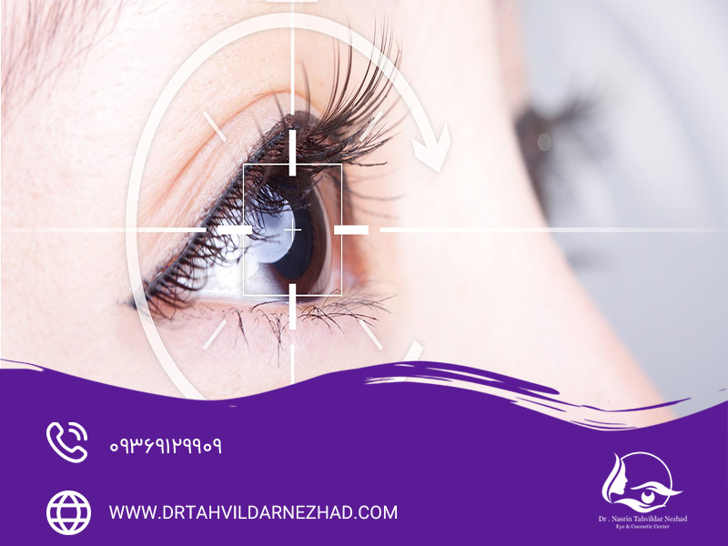 عمل جراحی کاشت لنز داخل چشمی ICL چیست