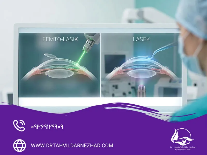 تفاوت عمل فمتولیزیک و لازک؛ مقایسه کامل دو روش اصلاح بینایی