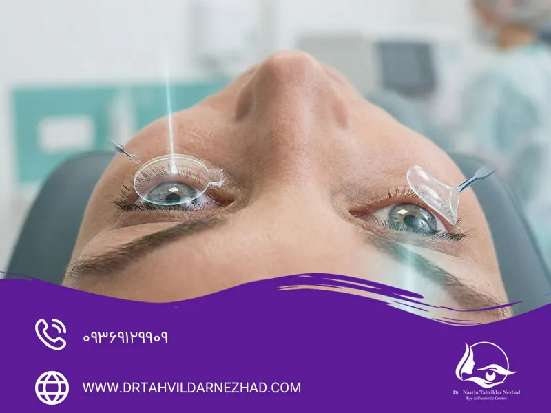 چه کسانی کاندیدای مناسب فمتولیزیک هستند؟