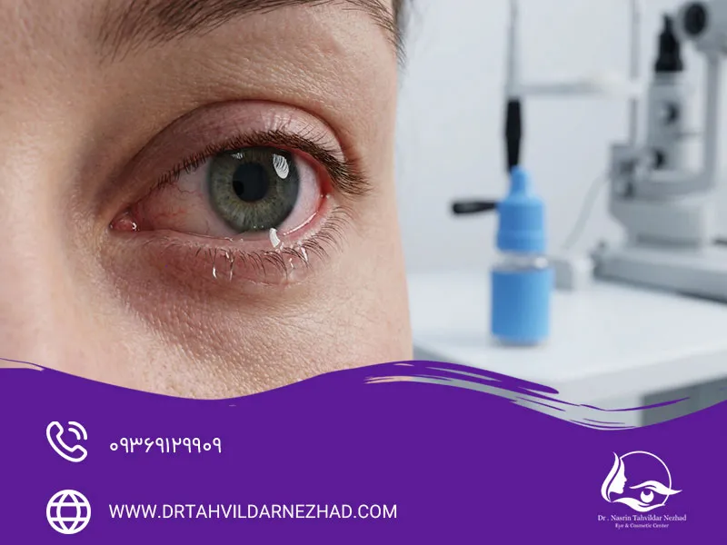 خشکی چشم چیست؟ روش‌های درمان و جلوگیری از آن